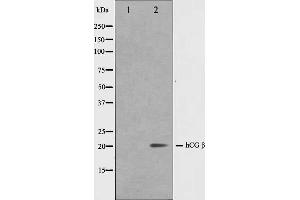 Western blot analysis on NIH-3T3 cell lysate using hCG beta Antibody,The lane on the left is treated with the antigen-specific peptide. (HCG beta anticorps)
