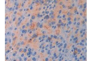 IHC-P analysis of Mouse Pancreas Tissue, with DAB staining. (IL18R1 anticorps  (AA 182-336))