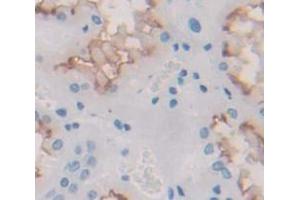 IHC-P analysis of Human Tissue, with DAB staining. (IL12RB1 anticorps  (AA 429-603))