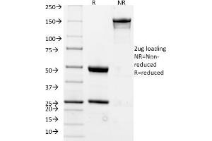 SDS-PAGE Analysis Purified CD20 Mouse Monoclonal Antibody (L26). (CD20 anticorps)