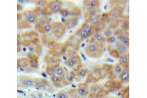 Used in DAB staining on fromalin fixed paraffin-embedded Liver tissue (Motilin anticorps  (AA 26-115))