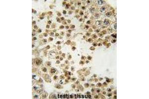 Immunohistochemistry (IHC) image for anti-Parkinson Protein 2, E3 Ubiquitin Protein Ligase (Parkin) (PARK2) antibody (ABIN3002636)