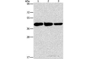 Western blot analysis of Human normal liver tissue, mouse brain and heart tissue, using GOT1 Polyclonal Antibody at dilution of 1:1600 (GOT1 anticorps)
