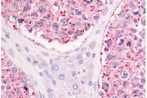 Human Testis (formalin-fixed, paraffin-embedded) stained with GPR68 antibody ABIN213456 at 10-20 ug/ml followed by biotinylated goat anti-rabbit IgG secondary antibody ABIN481713, alkaline phosphatase-streptavidin and chromogen.