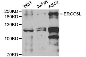 Western blot analysis of extracts of various cell lines, using ERCC6L antibody (ABIN6134675, ABIN6140273, ABIN6140275 and ABIN6221741) at 1:1000 dilution. (ERCC6L anticorps  (AA 300-400))