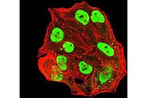 Immunofluorescence analysis of Hela cells using ESR1 mouse mAb (green). (Estrogen Receptor alpha anticorps  (AA 2-185))