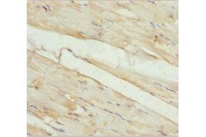 Immunohistochemistry of paraffin-embedded human skeletal muscle tissue using ABIN7157248 at dilution of 1:100 (KBTBD3 anticorps  (AA 1-350))