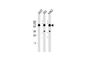 All lanes :SET07 Antibody at 1:2000 dilution Lane 1: 293T whole cell lysate Lane 2: 293 whole cell lysate Lane 3: K562 whole cell lysate Lysates/proteins at 20 μg per lane. (SETD8 anticorps  (N-Term))