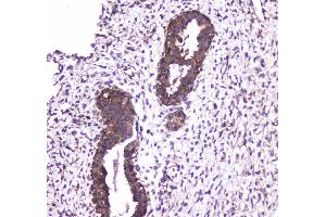 IHC analysis of Caspase 4 using anti-Caspase 4 antibody .