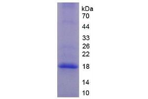 SDS-PAGE (SDS) image for Complement Factor P (CFP) (AA 310-459) protein (His tag) (ABIN1170210) (CFP Protein (AA 310-459) (His tag))