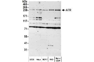 Western Blotting (WB) image for anti-ATR serine/threonine kinase (ATR) (AA 400-450) antibody (ABIN7450015)
