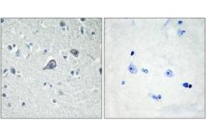 Immunohistochemistry analysis of paraffin-embedded human brain tissue, using ADORA2A Antibody. (Adenosine A2a Receptor anticorps  (AA 120-169))