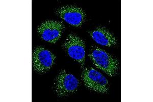 Confocal immunofluorescent analysis of GSR Antibody (C-term) (ABIN655985 and ABIN2845369) with NCI- cell followed by Alexa Fluor 488-conjugated goat anti-rabbit lgG (green).