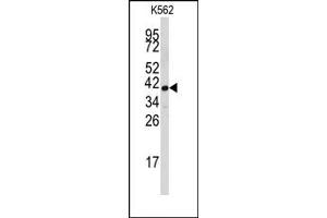 Image no. 1 for anti-Fibrillarin (FBL) (Middle Region) antibody (ABIN357938) (Fibrillarin anticorps  (Middle Region))