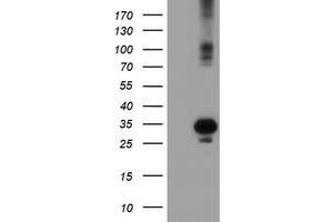 Western Blotting (WB) image for anti-Suppressor of Cytokine Signaling 3 (SOCS3) antibody (ABIN1501063) (SOCS3 anticorps)