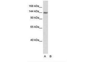 Image no. 1 for anti-Timeless Homolog (TIMELESS) (C-Term) antibody (ABIN202978) (TIMELESS anticorps  (C-Term))