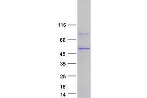 Validation with Western Blot