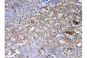IHC analysis of XRCC1 using anti-XRCC1 antibody .