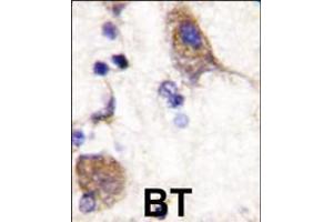 Formalin-fixed and paraffin-embedded human brain tissue reacted with SCYL2 , which was peroxidase-conjugated to the secondary antibody, followed by DAB staining.