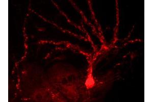Indirect immunostaining of rat hippocampus neurons (dilution 1 : 500)