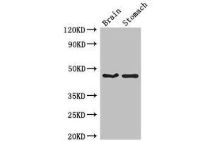 Western Blot Positive WB detected in: Mouse brain tissue, Mouse stomach tissue All lanes: TBC1D20 antibody at 4 μg/mL Secondary Goat polyclonal to rabbit IgG at 1/50000 dilution Predicted band size: 46, 20, 49 kDa Observed band size: 46 kDa (TBC1D2 anticorps  (AA 1-237))