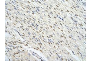 Rabbit Anti-FOXJ3 antibody        Paraffin Embedded Tissue:  Human Heart cell   Cellular Data:  Epithelial cells of renal tubule  Antibody Concentration:   4. (FOXJ3 anticorps  (Middle Region))