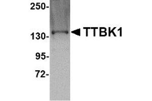 Western Blotting (WB) image for anti-tau Tubulin Kinase 1 (Ttbk1) (C-Term) antibody (ABIN1030783) (TTBK1 anticorps  (C-Term))