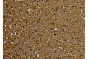 ABIN6277542 at 1/100 staining Rat brain tissue by IHC-P.