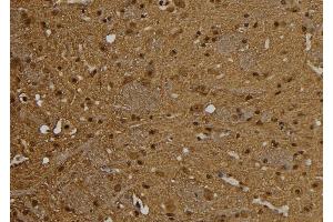 ABIN6277542 at 1/100 staining Rat brain tissue by IHC-P. (PSME1 anticorps  (C-Term))