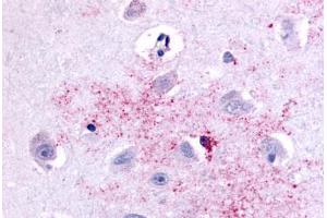 Anti-PAK6 antibody  ABIN1049228 IHC staining of human brain, neurons and glia. (PAK6 anticorps  (Linker Domain))