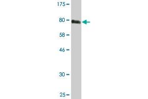 Western Blot detection against Immunogen (76. (STK38 anticorps  (AA 1-465))