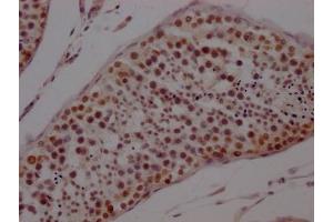 IHC image of ABIN7127781 diluted at 1:100 and staining in paraffin-embedded human testis tissue performed on a Leica BondTM system.