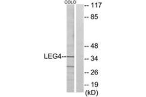 Western blot analysis of extracts from COLO cells, using LEG4 Antibody. (GAL4 anticorps  (AA 61-110))