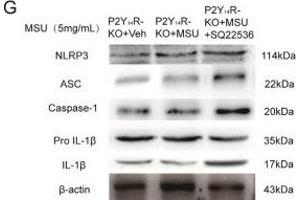 Decreased cAMP exaggerated acute gouty arthritis in P2Y14R-KO rats. (Caspase 1 p20 anticorps  (AA 181-280))