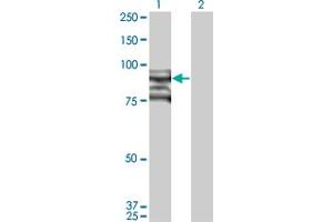 Western Blot analysis of TOP3B expression in transfected 293T cell line by TOP3B monoclonal antibody (M03), clone 1H8. (TOP3B anticorps  (AA 1-862))