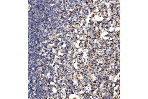 IHC analysis of MRPS25 using anti-MRPS25 antibody (ABIN7599032).