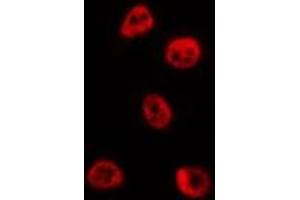 ABIN6273993 staining HepG2 by IF/ICC. (BCL6 anticorps  (Internal Region))