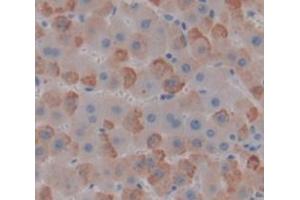Used in DAB staining on fromalin fixed paraffin- embedded liver tissue (GUCY1B3 anticorps  (AA 408-619))