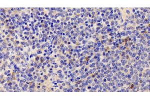 Detection of IL22R in Human Spleen Tissue using Polyclonal Antibody to Interleukin 22 Receptor (IL22R) (IL22R anticorps  (AA 267-565))