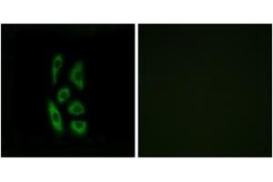 Immunofluorescence analysis of A549 cells, using ACOT12 Antibody.