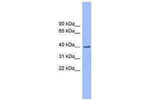 WB Suggested Anti-EXOD1 Antibody Titration: 0. (ERI2 anticorps  (N-Term))
