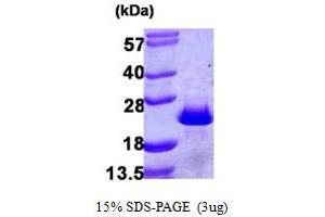SDS-PAGE (SDS) image for Programmed Cell Death 6 (PDCD6) (AA 1-191) protein (His tag) (ABIN667892)