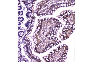 IHC analysis of TANK using anti-TANK antibody (ABIN6719508). (TANK anticorps)