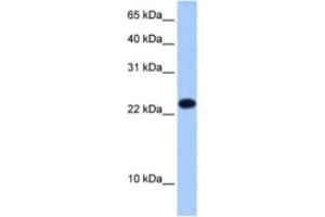 Western Blotting (WB) image for anti-Eukaryotic Translation Initiation Factor 4E Family Member 3 (EIF4E3) antibody (ABIN2462352) (EIF4E3 anticorps)