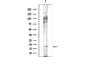 anti-Mitochondrial Ribosomal Protein L51 (MRPL51) (C-Term) antibody