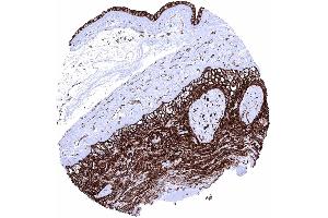 Placenta amnion and chorion Membranous GLUT1 staining is very intense in amnion and chorion cells.