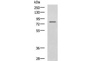 Western blot analysis of Rat liver tissue lysate using DHX58 Polyclonal Antibody at dilution of 1:800 (DHX58 anticorps)
