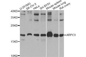 Western blot analysis of extracts of various cell lines, using ARPC3 Antibody (ABIN2736304) at 1:1000 dilution.