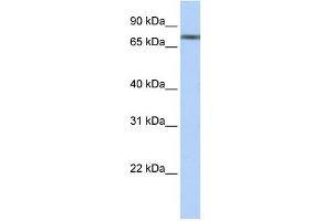 WB Suggested Anti-TRIM29 Antibody Titration:  0. (TRIM29 anticorps  (N-Term))