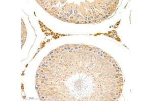 Immunohistochemistry of paraffin embedded rat testis using erf1 (ABIN7073895) at dilution of 1: 2400 (400x lens)
